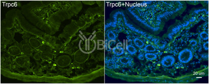 Trpc6 (C-Terminus) Antibody - FFPE Validated