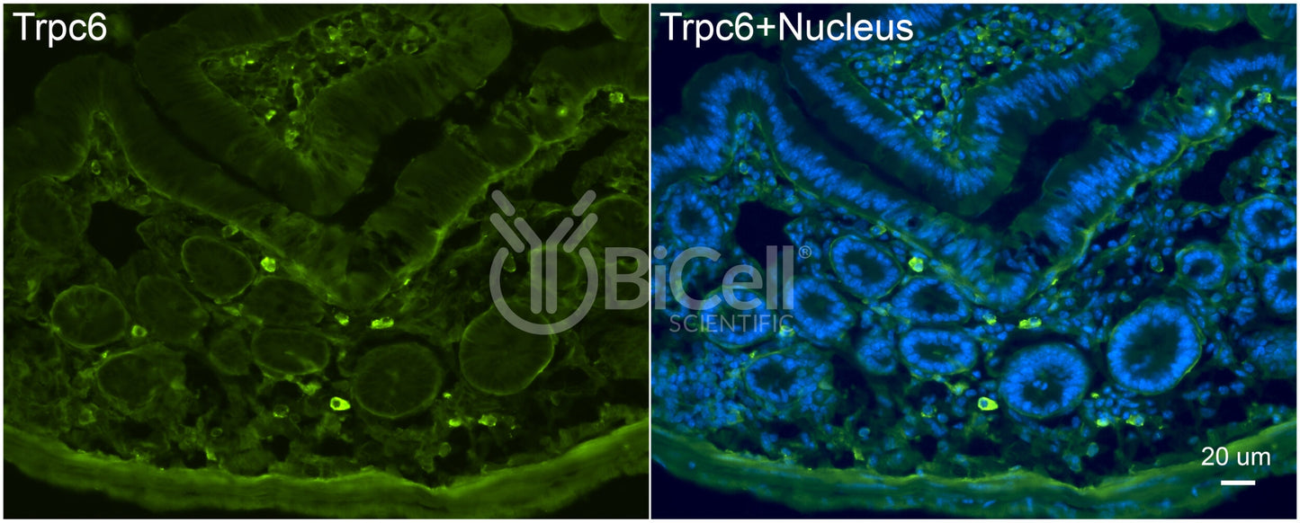 Trpc6 (C-Terminus) Antibody