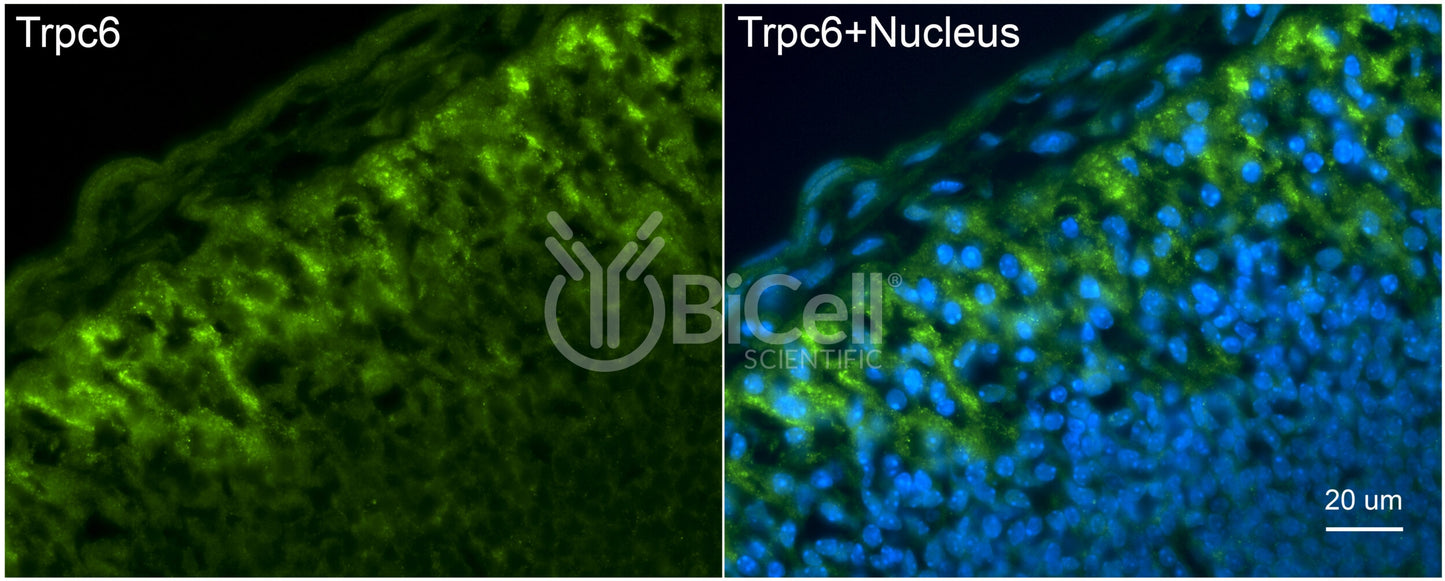 Trpc6 (N-Terminus) Antibody - FFPE Validated