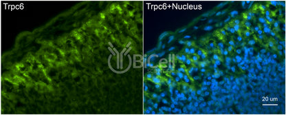 Trpc6 (N-Terminus) Antibody