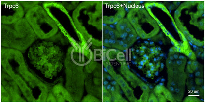 Trpc6 (N-Terminus) Antibody - FFPE Validated
