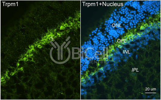 Trpm1 Antibody