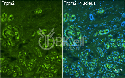 Trpm2 Antibody - Western Blot Validated