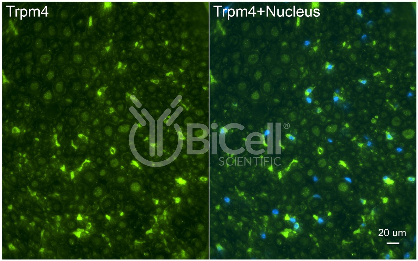 Trpm4 Antibody - Western Blot Validated