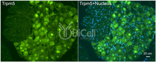 Trpm5 Antibody - FFPE Validated