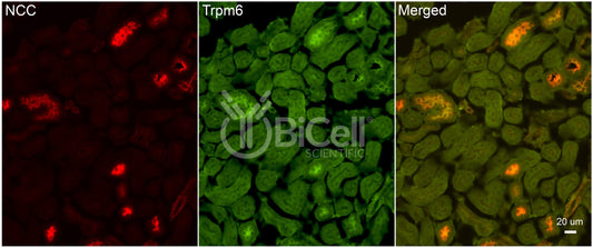 Trpm6 Antibody - Western Blot Validated