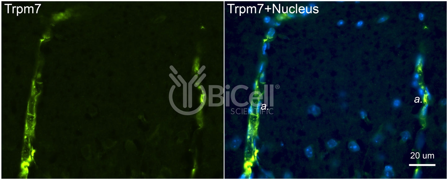 Trpm7 Antibody