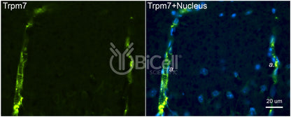 Trpm7 Antibody