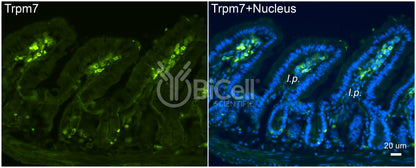 Trpm7 Antibody