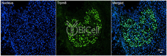 Trpm8 Antibody - Western Blot Validated