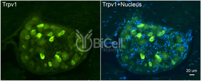 Trpv1 Antibody - FFPE Validated