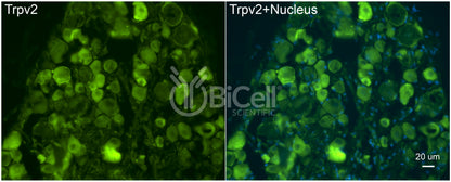 Trpv2 Antibody - Western Blot Validated