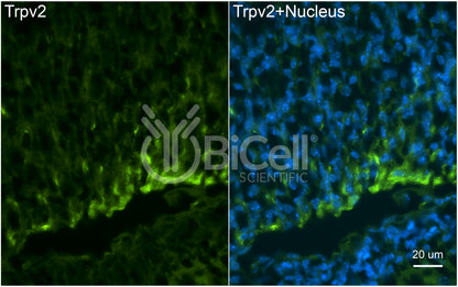 Trpv2 Antibody - Western Blot Validated