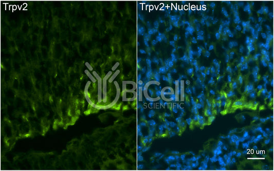 Trpv2 Antibody - Western Blot Validated