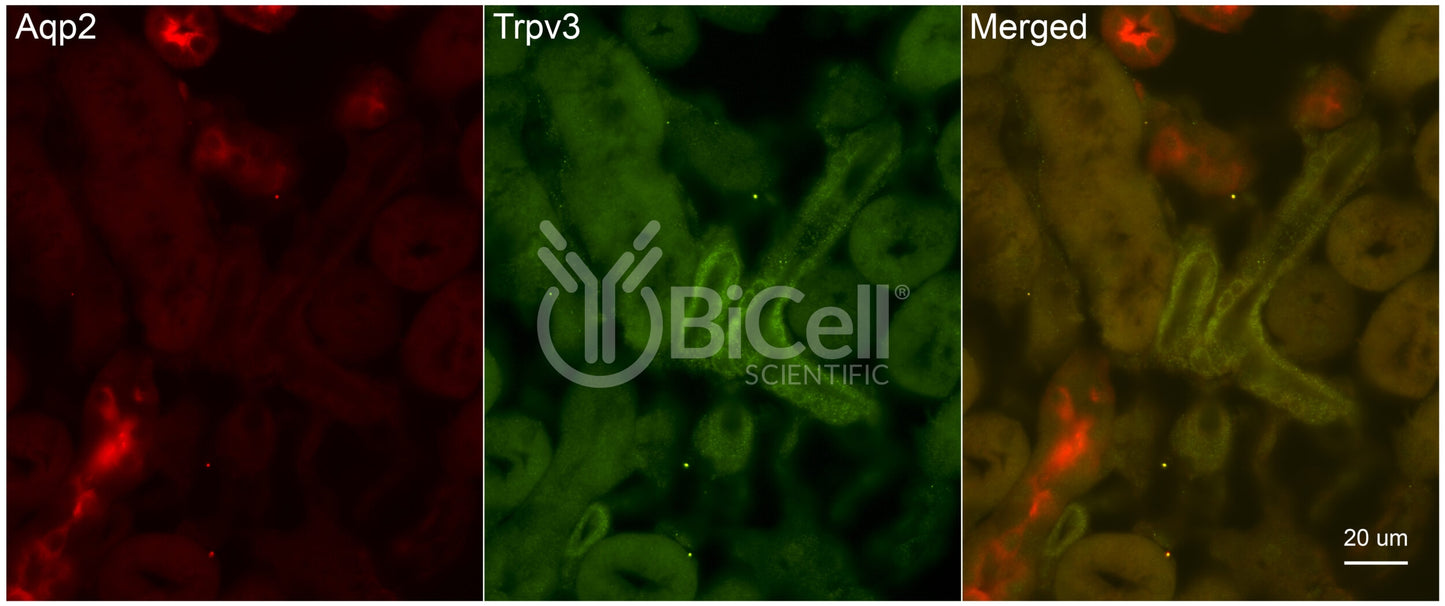 Trpv3 Antibody - FFPE Validated