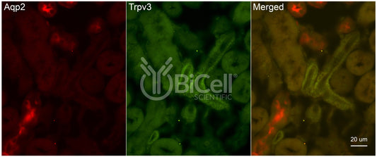 Trpv3 Antibody - FFPE Validated