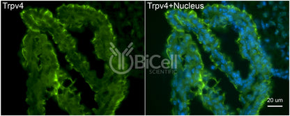 Trpv4 Antibody - FFPE Validated