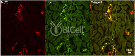 Trpv5 Antibody - Western Blot Validated