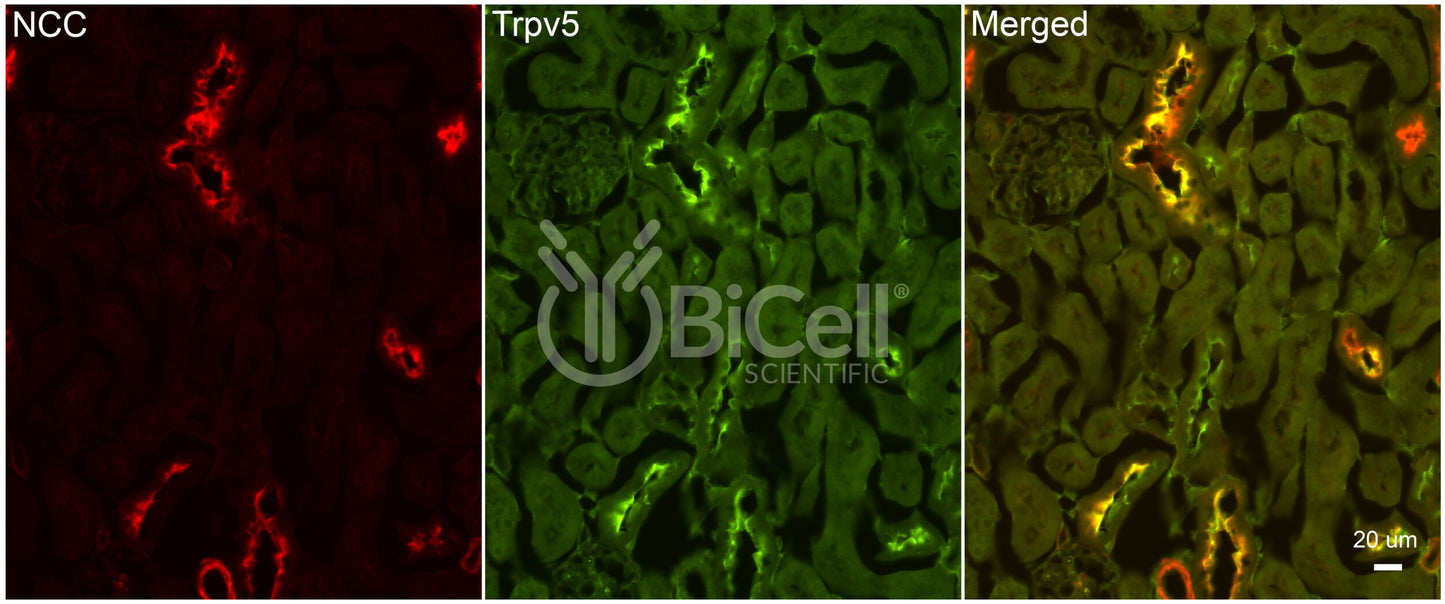 Trpv5 Antibody - FFPE Validated