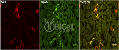 Trpv5 Antibody - FFPE Validated