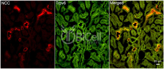 Trpv6 Antibody