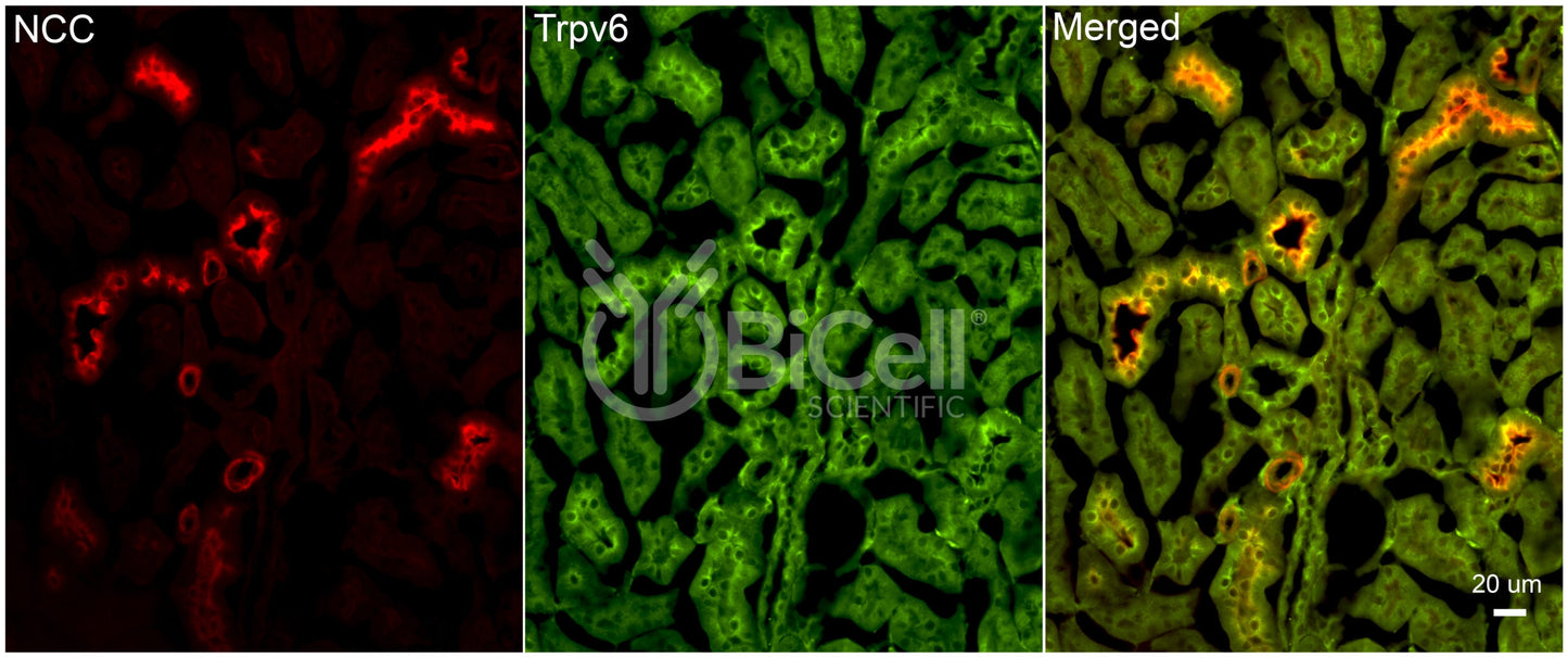 Trpv6 Antibody - FFPE Validated