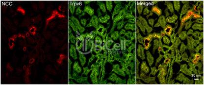 Trpv6 Antibody - FFPE Validated