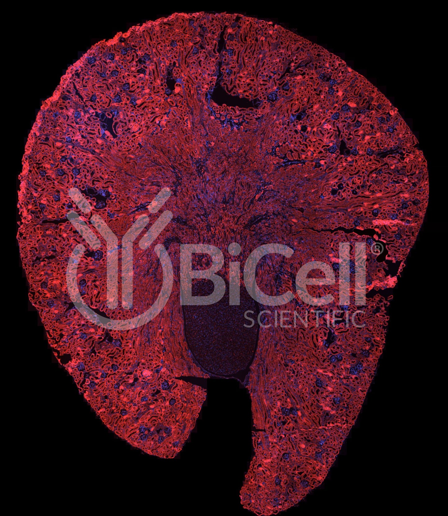 Trpv6 Antibody