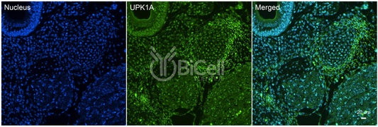 Tetraspanin-21 (TSPAN21 or Uroplakin-1a or UPK1A or UPKA) Antibody