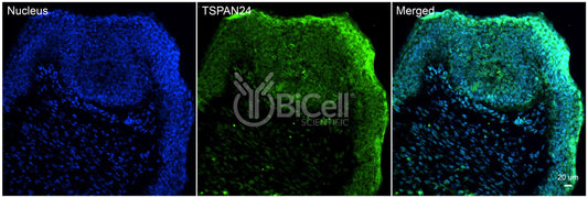 Tetraspanin-24 (TSPAN24 or CD151) Antibody