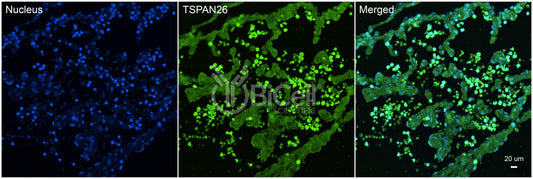 Tetraspanin-26 (TSPAN26 or CD37) Antibody - Western Blot Validated