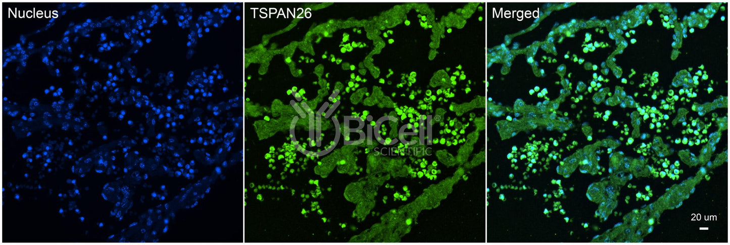 Tetraspanin-26 (TSPAN26 or CD37) Antibody - FFPE Validated