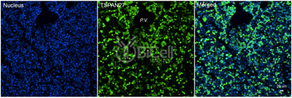 Tetraspanin-27 (TSPAN27 or CD82 or KAI1) Antibody - Western Blot Validated