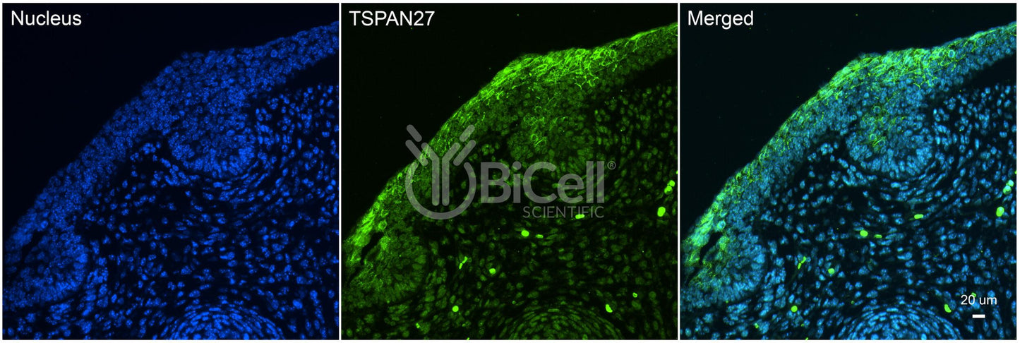 Tetraspanin-27 (TSPAN27 or CD82 or KAI1) Antibody - Western Blot Validated