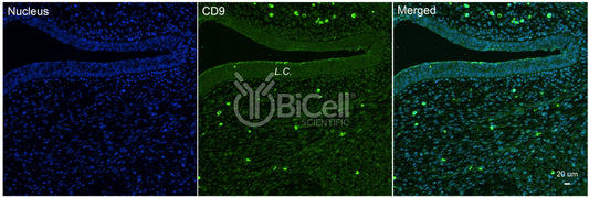 Tetraspanin-29 (TSPAN29 or CD9) Antibody
