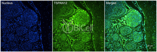 Tetraspanin-12 (TSPAN12) Antibody - FFPE Validated