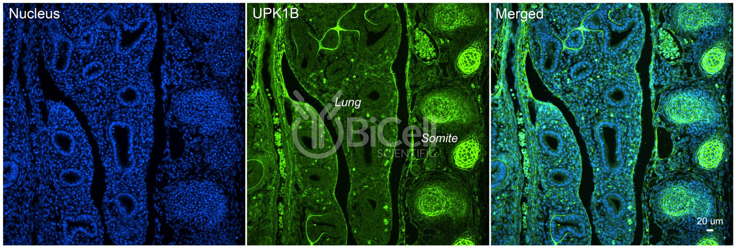 Tetraspanin-20 (TSPAN20 or Uroplakin-1b or UPK1B or UPK1) Antibody - Western Blot Validated