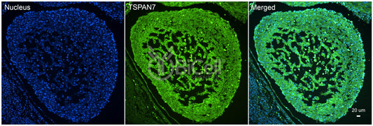 Tetraspanin-7 (TSPAN7) Antibody - FFPE Validated