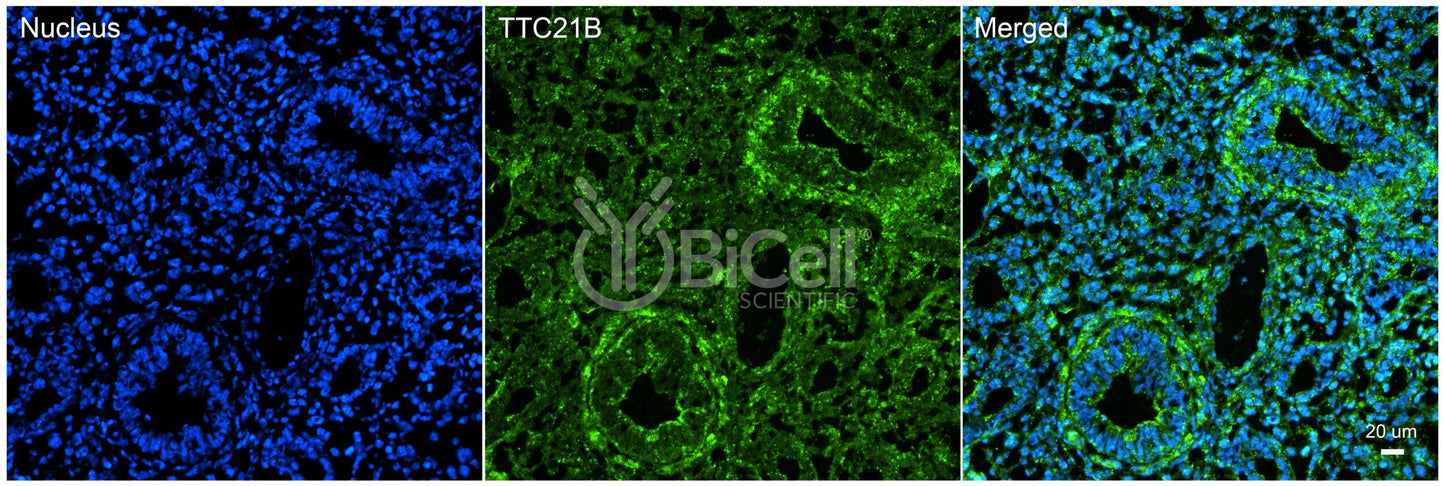 TTC21B (IFT139 or NPHP12) Antibody - Western Blot Validated