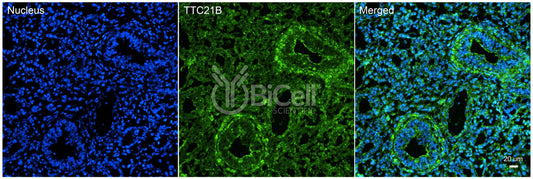TTC21B (IFT139 or NPHP12) Antibody - Western Blot Validated