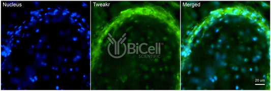 TNFRSF12A (TWEAKR or CD266) Antibody - Western Blot Validated