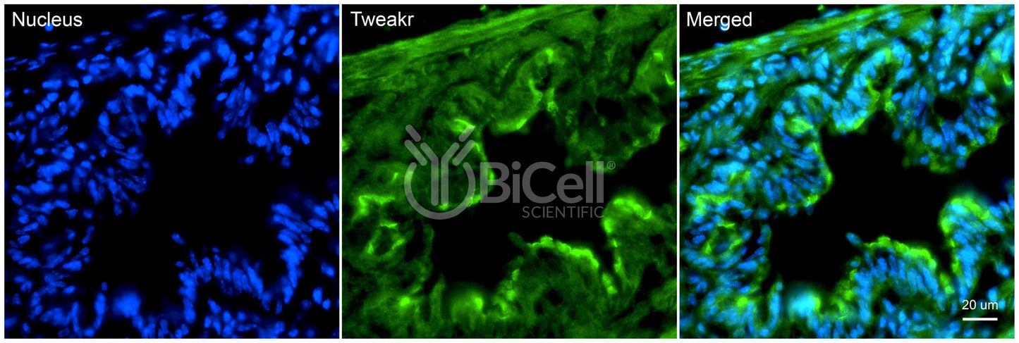 TNFRSF12A (TWEAKR or CD266) Antibody - FFPE Validated
