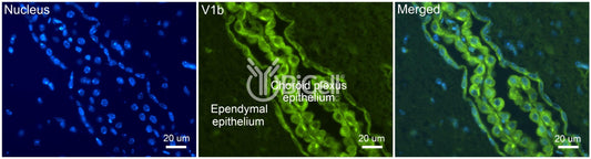 AVPR1b Antibody - FFPE Validated