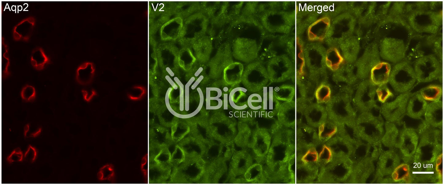 AVPR2 Antibody - Western Blot Validated