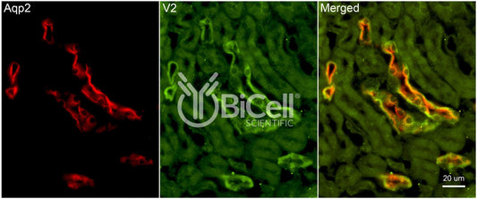 AVPR2 Antibody - FFPE Validated