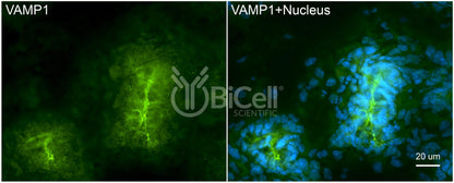 VAMP1 (SYB1) HiRe Antibody - FFPE Validated