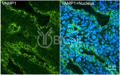 VAMP1 (SYB1) HiRe Antibody - FFPE Validated