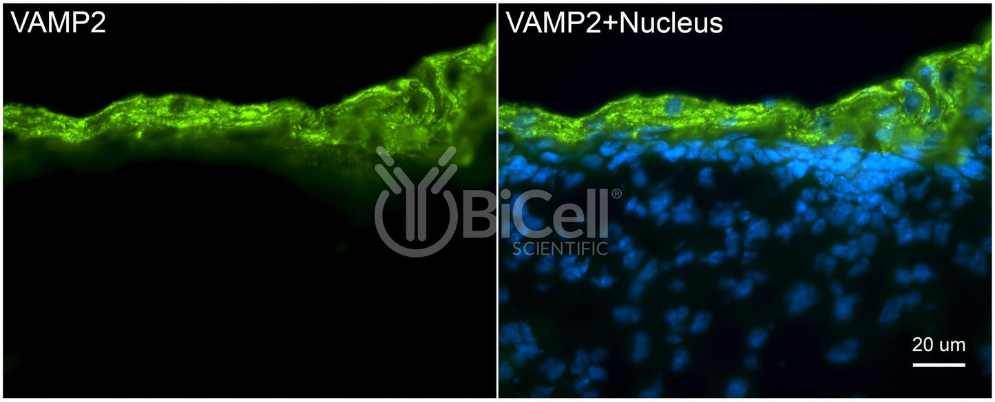 VAMP2 (SYB2) Antibody - Western Blot Validated