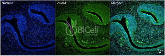 VCAM1 (CD106) Antibody - Western Blot Validated