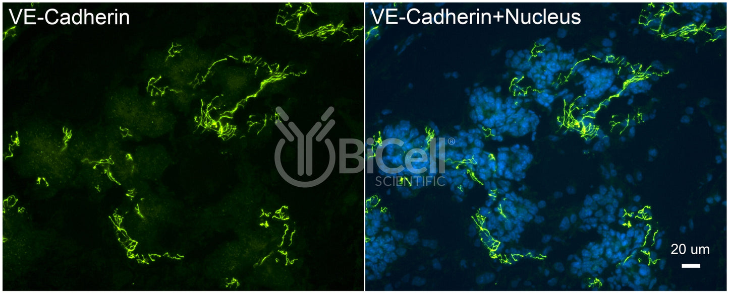 VE-cadherin (Cdh5 or Cadherin-5 or CD144) Antibody - Western Blot Validated